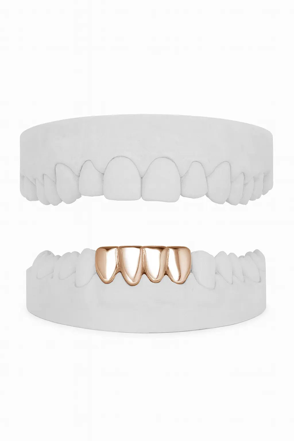 Custom Lower 4 Set Grillz UK in Rose Gold (9ct–18ct)