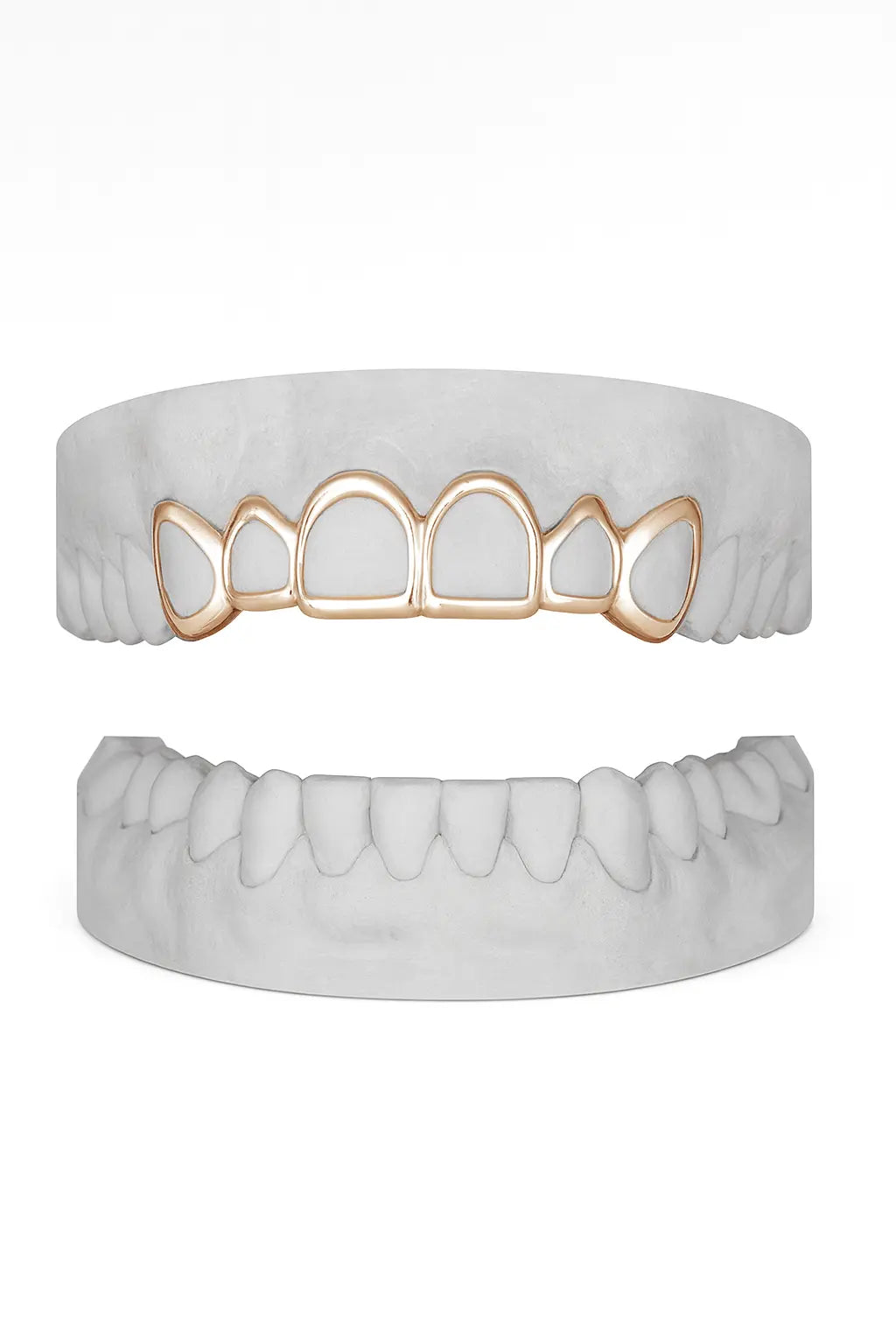 Custom 6 Set Windows Grillz UK in Rose Gold (9ct–18ct)