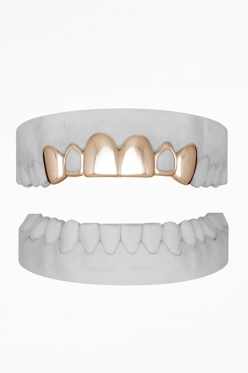 Custom 6 Set Window Laterals Grillz UK in Rose Gold (9ct–18ct)
