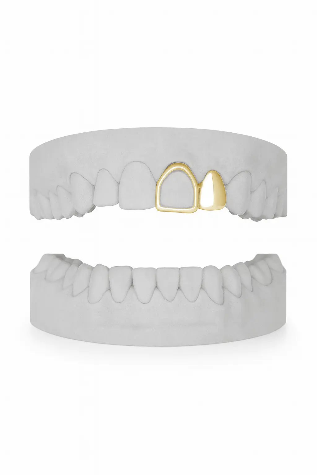 Custom Lateral & Front Window Grillz UK in Gold (9ct–18ct)