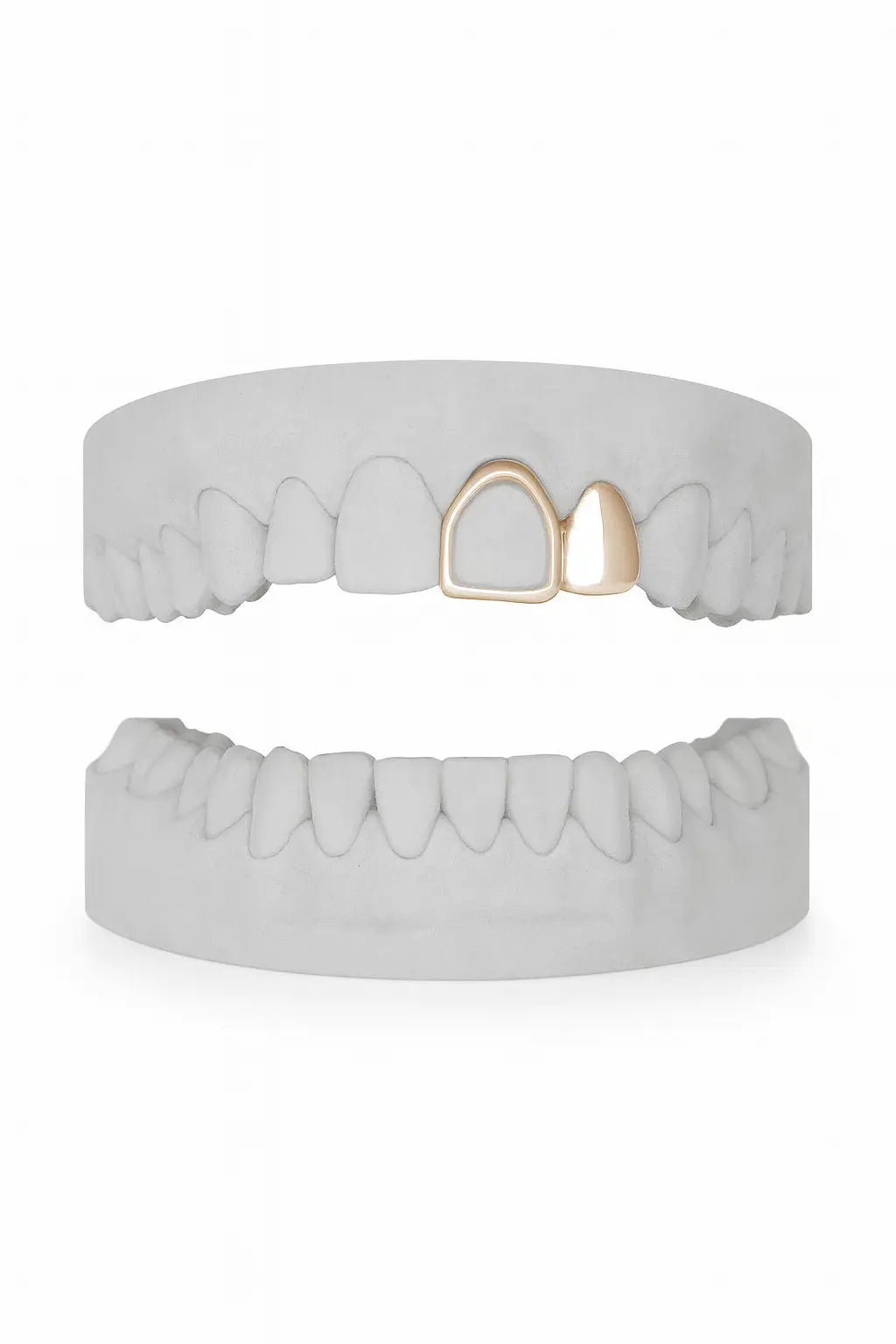 Custom Lateral & Front Window Grillz UK in Rose Gold (9ct–18ct)