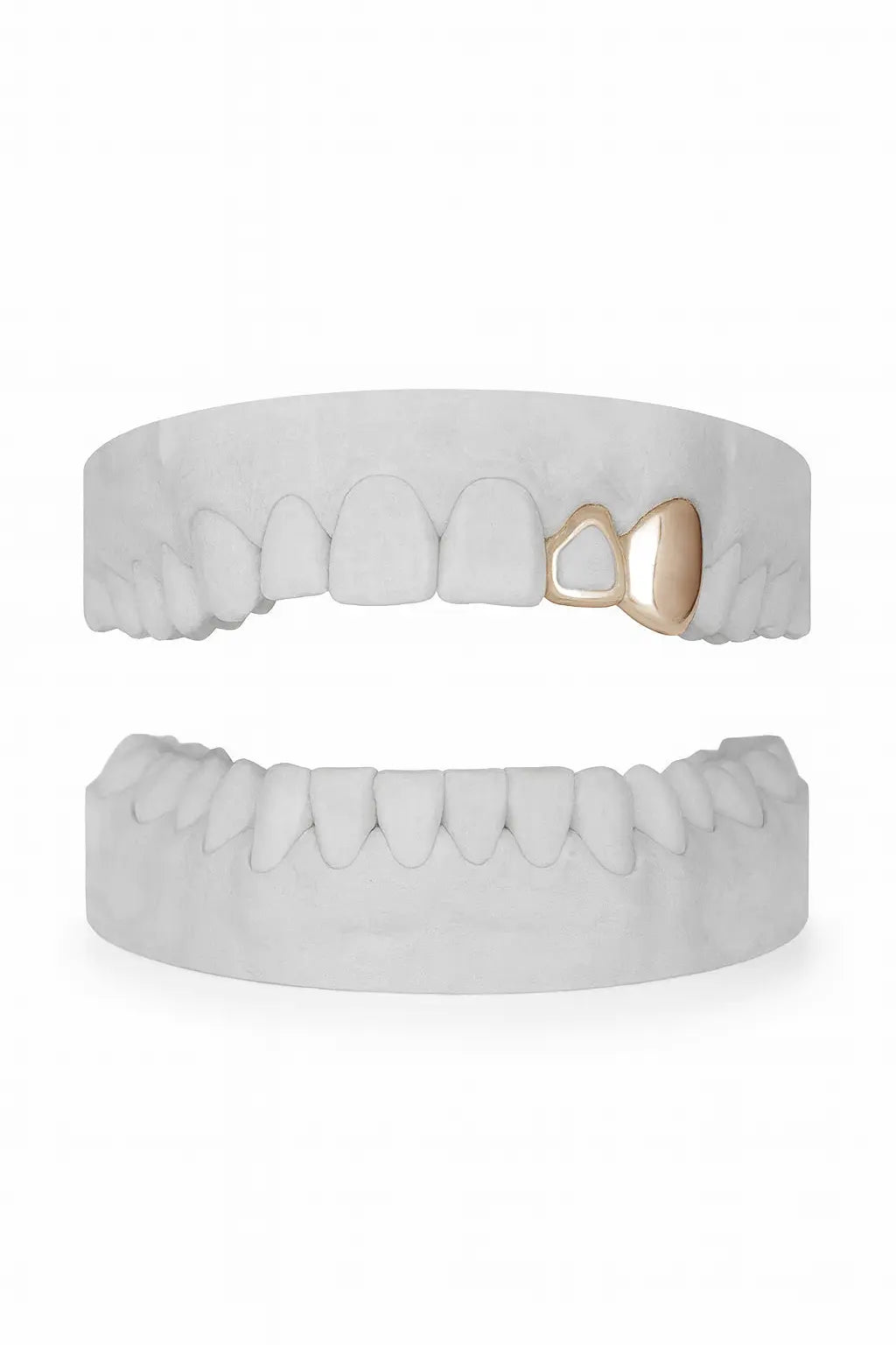 Custom Window Lateral & Canine Grillz UK in Rose Gold (9ct–18ct)