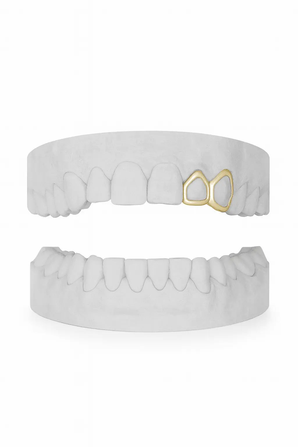 Custom Window Lateral & Window Canine Grillz UK in Gold (9ct–18ct)