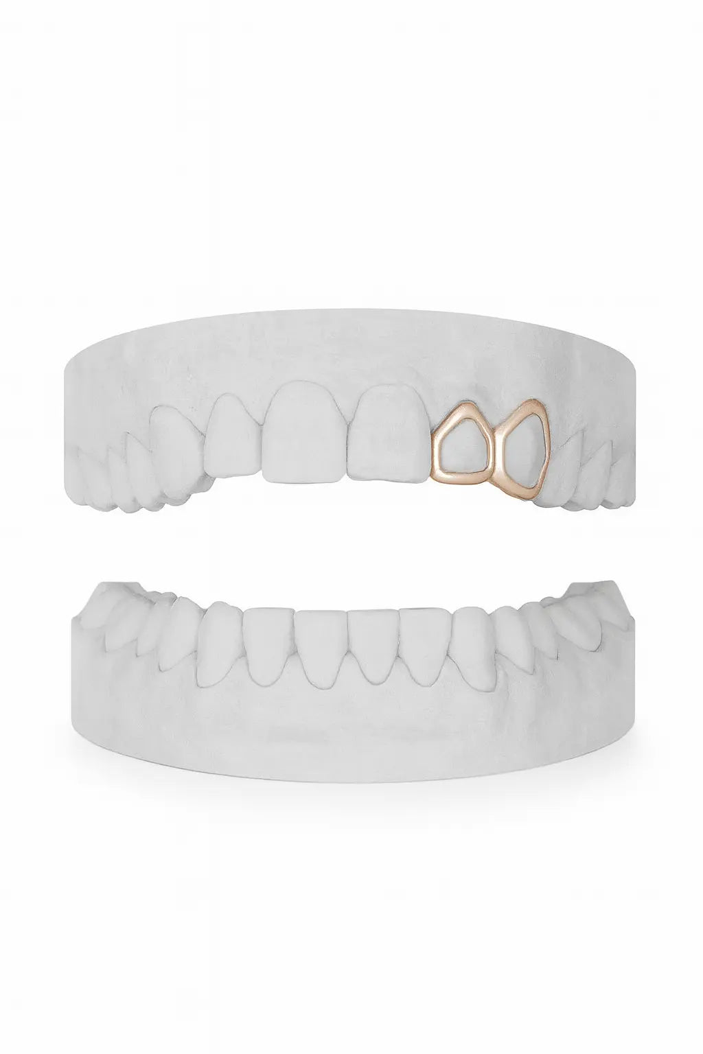 Custom Window Lateral & Window Canine Grillz UK in Rose Gold (9ct–18ct)