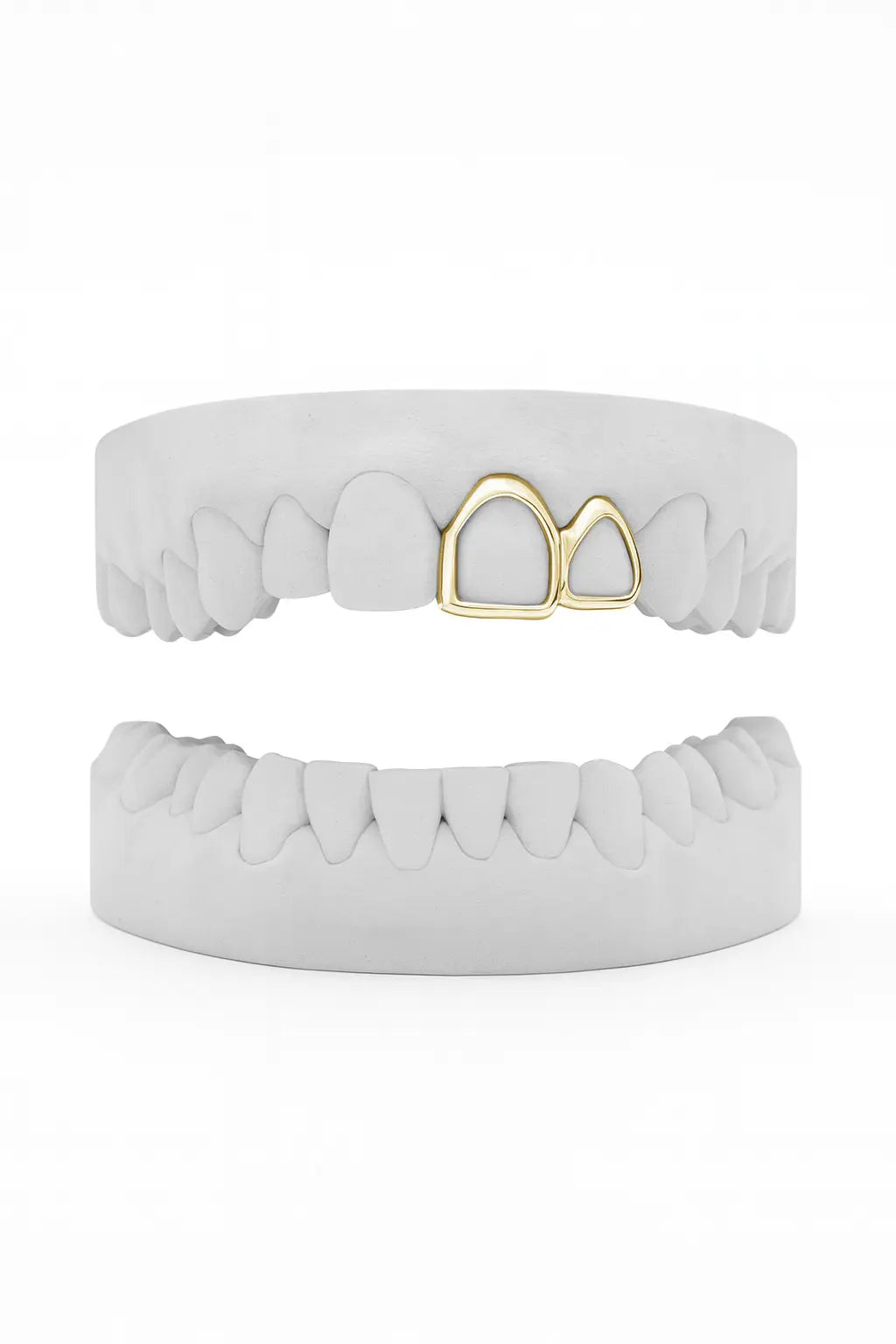 Custom Window Front & Window Lateral Grillz UK in Gold (9ct–18ct)