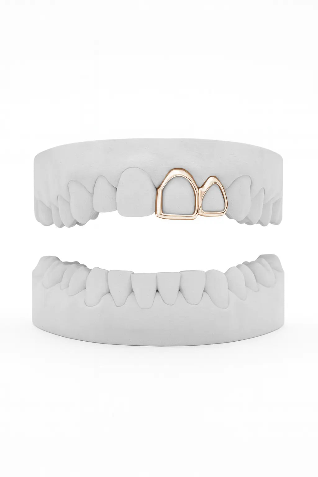 Custom Window Front & Window Lateral Grillz UK in Rose Gold (9ct–18ct)
