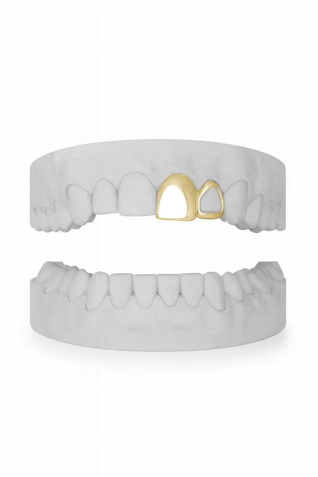 Custom Front & Window Lateral Grillz UK in Gold (9ct–18ct)