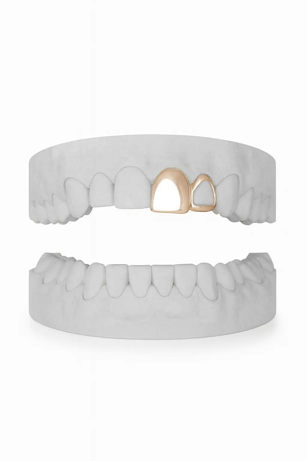 Custom Front & Window Lateral Grillz UK in Rose Gold (9ct–18ct)