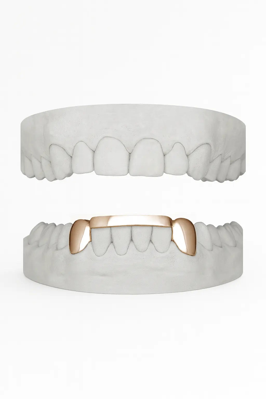 Custom 2 X Canines with Bar Grillz UK in Rose Gold (9ct–18ct)