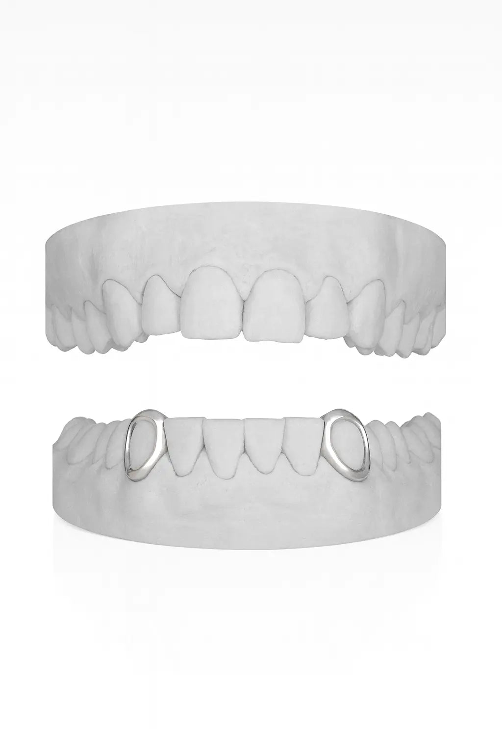 Custom 2 X Canine Windows (Lower) Grillz UK in Silver (9ct–18ct)