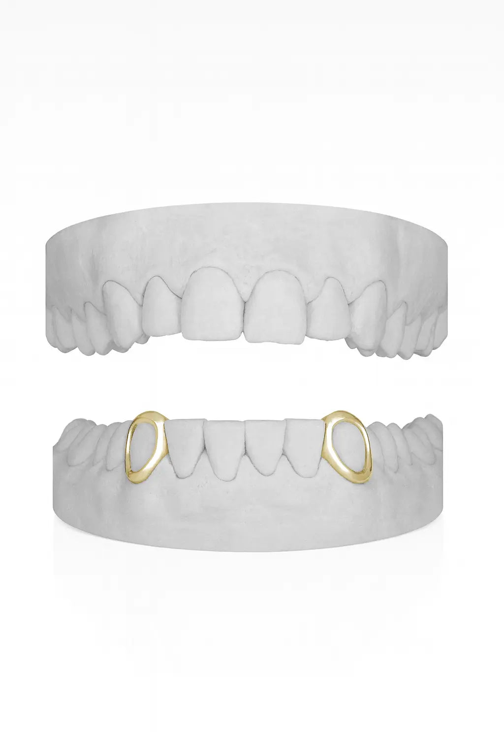 Custom 2 X Canine Windows (Lower) Grillz UK in Gold (9ct–18ct)