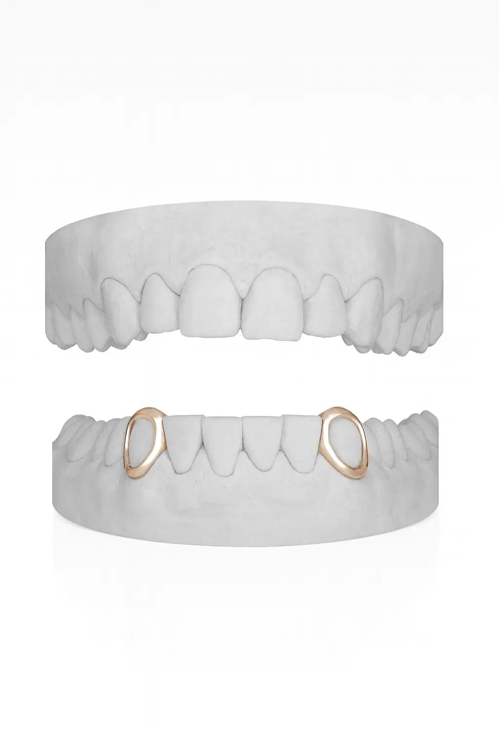 Custom 2 X Canine Windows (Lower) Grillz UK in Rose Gold (9ct–18ct)