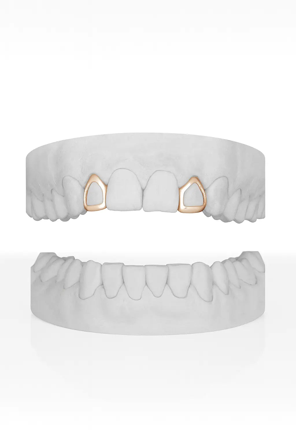 Custom 2 X Lateral Windows (Top) Grillz UK in Rose Gold (9ct–18ct)