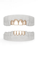 Custom Top 4 Bottom Set Grillz UK in Rose Gold (9ct–18ct)
