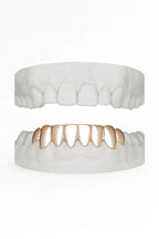 Custom Bottom 8 Set Grillz UK in Rose Gold (9ct–18ct)