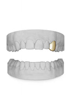 Custom Single Canine Grillz UK | Gold, Silver & Rose Gold (9ct–18ct) Grillz UK in Gold (9ct–18ct)