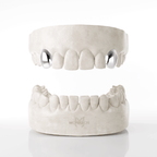 Double Canine Grillz (Top Teeth)