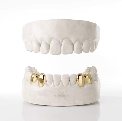 2 X Canine & Premolar (Bottom)
