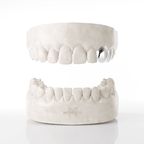 Canine & Premolar Grillz (Top Teeth)
