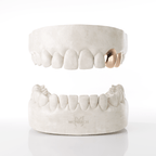 Canine & Premolar Grillz (Top Teeth)