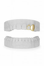 Custom Window Lateral & Canine Grillz UK in Gold (9ct–18ct)