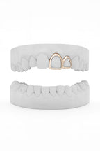 Custom Window Front & Window Lateral Grillz UK in Rose Gold (9ct–18ct)