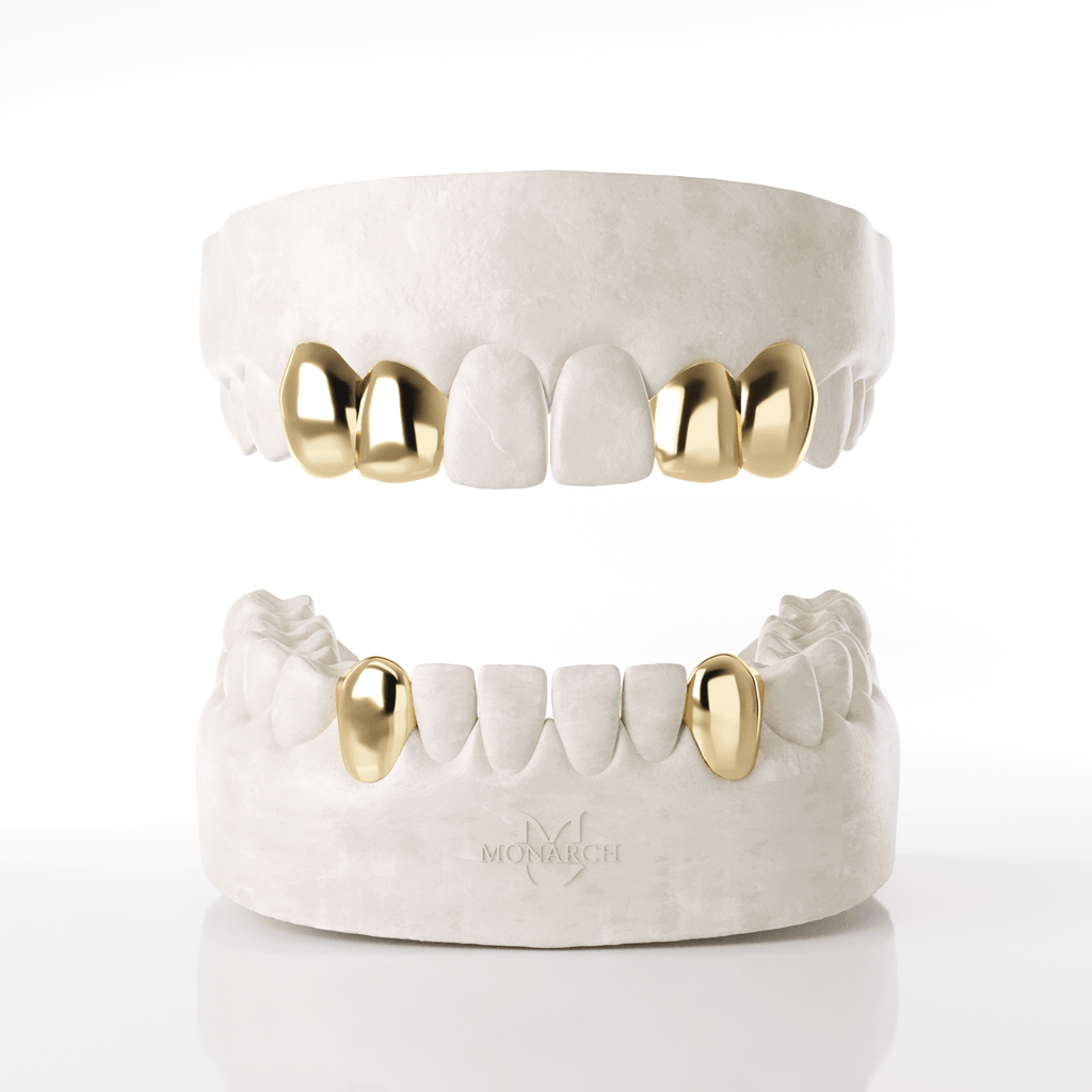2 X Canine Lateral (Top) & Bottom Canines