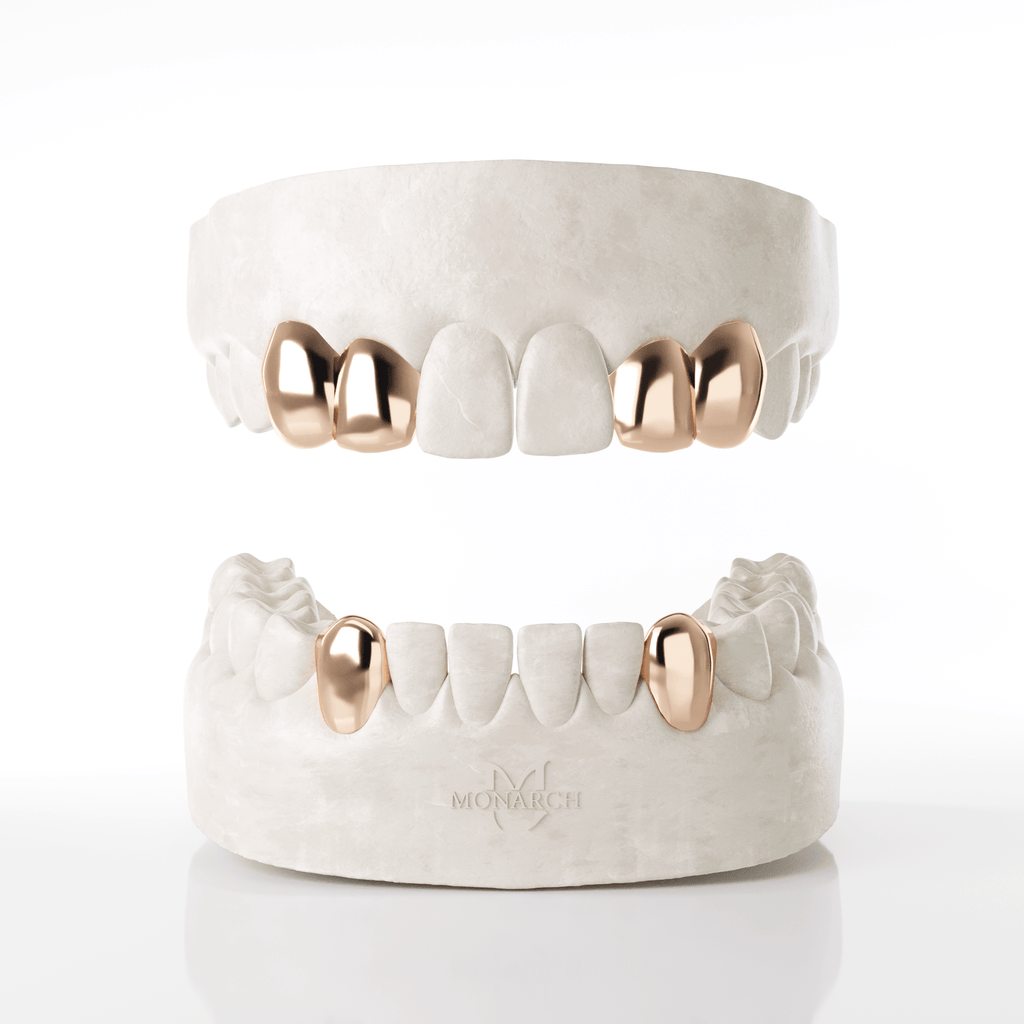2 X Canine Lateral (Top) & Bottom Canines