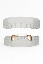 Custom 2 X Canines with Bar Grillz UK in Rose Gold (9ct–18ct)