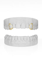 Custom 2 X Canine Windows (Top) Grillz UK in Gold (9ct–18ct)